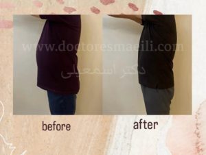 لاغری فردیس کرج، دکتر اسمعیلی