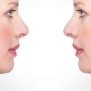 لاغری غبغب در مطب دکتر اسمعیلی فردیس کرج و تهران