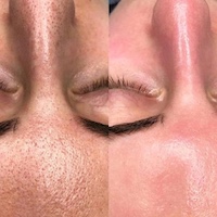 فیشال تخصصی